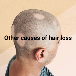 What causes hair loss 6 1